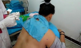 小针刀操作视频,精准施术，轻松掌握微创治疗技巧